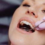 Защо избелването на зъбите е толкова популярно? Привлекателността на блестящата усмивка